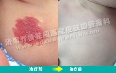 �������ϵĺ�̥����ɫԽ��Խ����ϱ�����ô��