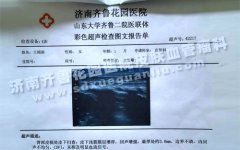 �������ϵĺ�ߵ���ʲôӦ����ô����