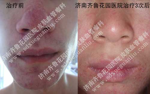 �����ǻ�������ǰ�����ƺ�ĶԱ���Ƭ