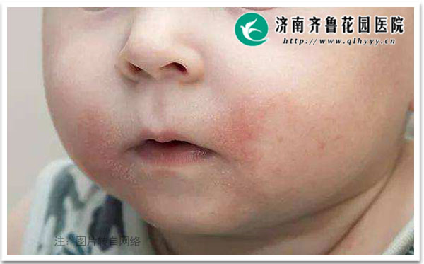 ��������Ѿ���ʳ�����ʷӦ���������ٽӴ�����ʳ��