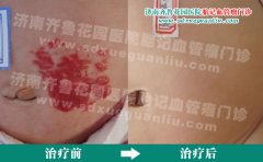 �������ϵĺ�ɫ�߿�������䶳����Ч������