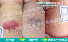 �ڼ��ϸ������θ첲�ϵĺ�ɫ��Ƭ�����κ���