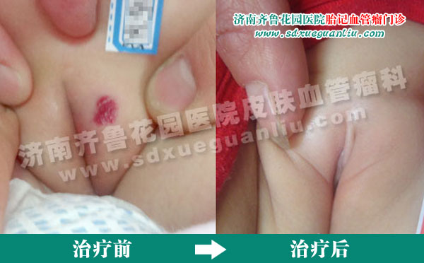 ���������Ʒ�����Ч���Ѫ����