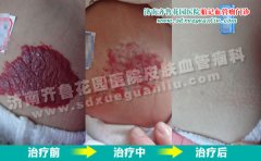 ���Ӷ����ϵĺ�ɫ�߿���Ѫ������ô�ж�����������