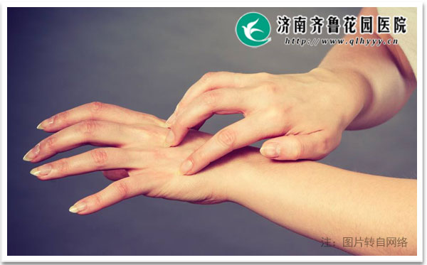 ��Ⱦ��Ƥ������Ҫ��Բ�ͬ�Ĳ�����������