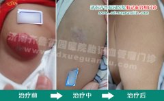 �ֱ��ϵĺ�ߵ�һ����û�г�����ҪȥҽԺ����