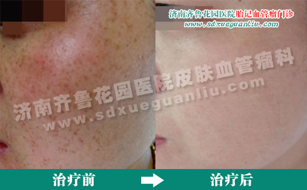 ȸ�����ϵ�ȸ�߾����������Ʒ�����ǰ�����ƺ�ĶԱ���Ƭ