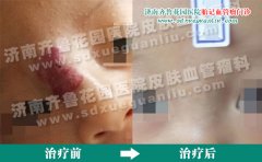 ������ֻ�۾��м䳤����������λ�Ӱ��������