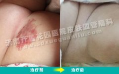 ���������ϵĺ�ɫ�߿���͹�����λ᲻������