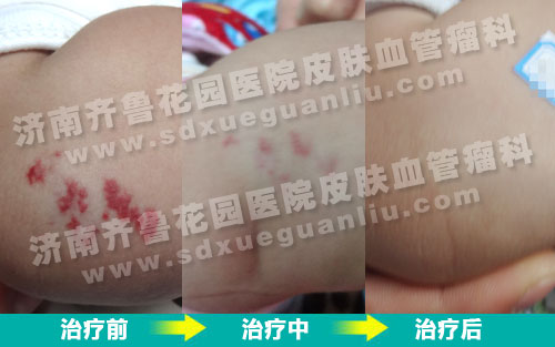 ����Ҹ�µĺ�ߵ㵽����Ų���������