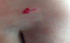 ƨ���ϵĺ�ɫ�߿���ɫ����������ͻ����Ѫ������