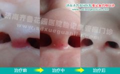 ���ӱ����ϵĺ�ɫ��Ƭ��ô���ܳ����κ�