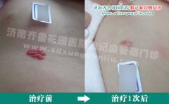 ���������·��ĺ�ɫ��Ƭ����һ�κ�Ҫ�ٽ���������