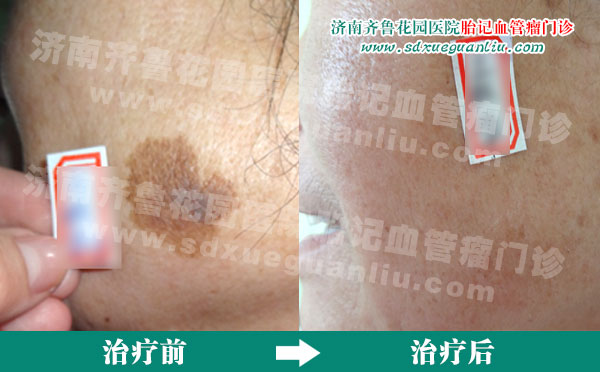 ���ϵ���������ƺ�ǰ��Ա���Ƭ