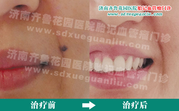 �������ϵ����Ӿ�������³��԰ҽԺ���ƺ�