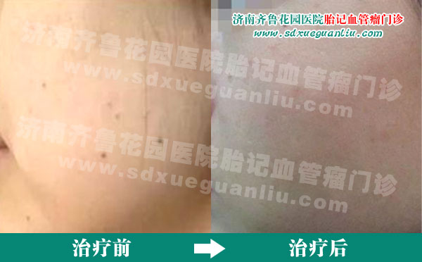 �沿ɫ���뻼�߾�������³��԰ҽԺƤ��������ǰ��Ա���Ƭ