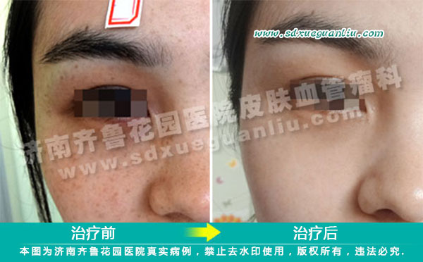 ����ȸ���ܹ�ȥ����