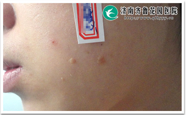 ��ƽ��ķ������ڲ�����Ⱦ�����