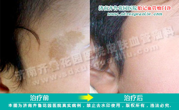 ���Ȱ���һ�������Լ���