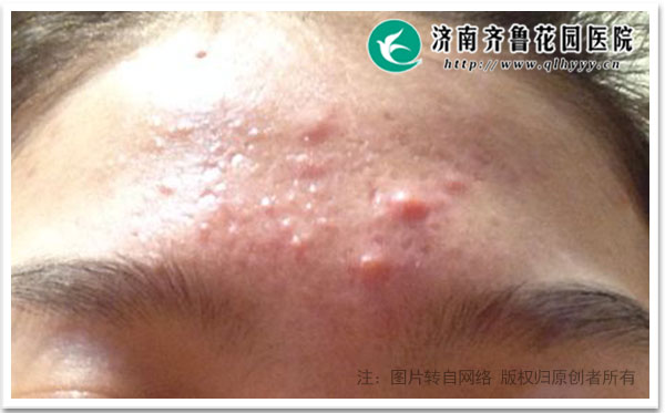 ��ͷ�ϳ�����ԭ������Ϊ��������ѹ��������Ƣ������