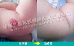 ���Ӹ첲�ϵ�С���������͹��ĺ����ô��