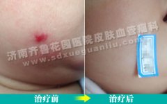 ����̥�ǳ���Ӱ��Ƥ�������⻹�б��Σ����