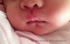 �������кͱ�ͷ�ĺ����Ѫ��������̥��