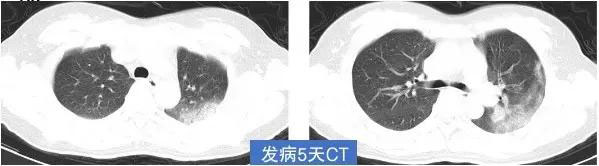 ͹״CTĻ