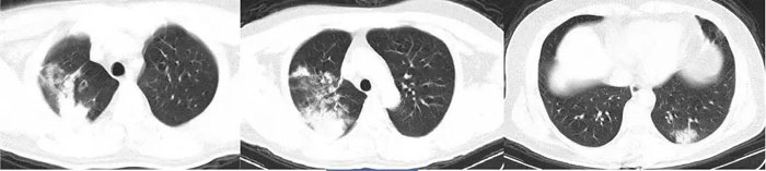 ͹״CT