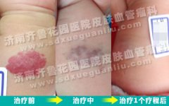 �����첲�ϳ���ߵ����Ƶ�ʱ��᲻����