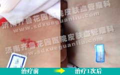 ���������ϵĺ�ߵ�ʹ�����һ���������