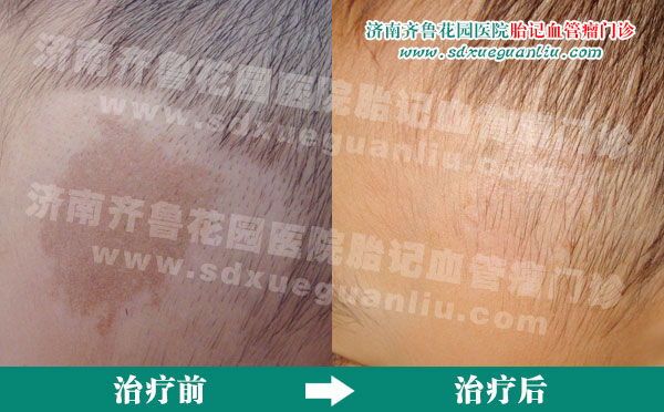 ��ɫ̥�����ٴ��ϳ������ǿ��Ȱ�