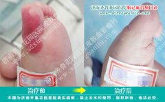 ��ֺͷ�ϵ�С��㵽�����β�����