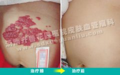 ���ϳ�С�����ʲô�����ȷ���ǲ���Ѫ����